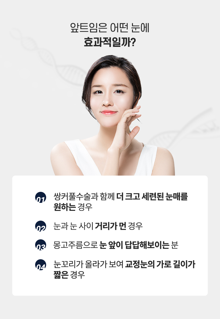 앞트임은 어떤눈에 효과적일까?