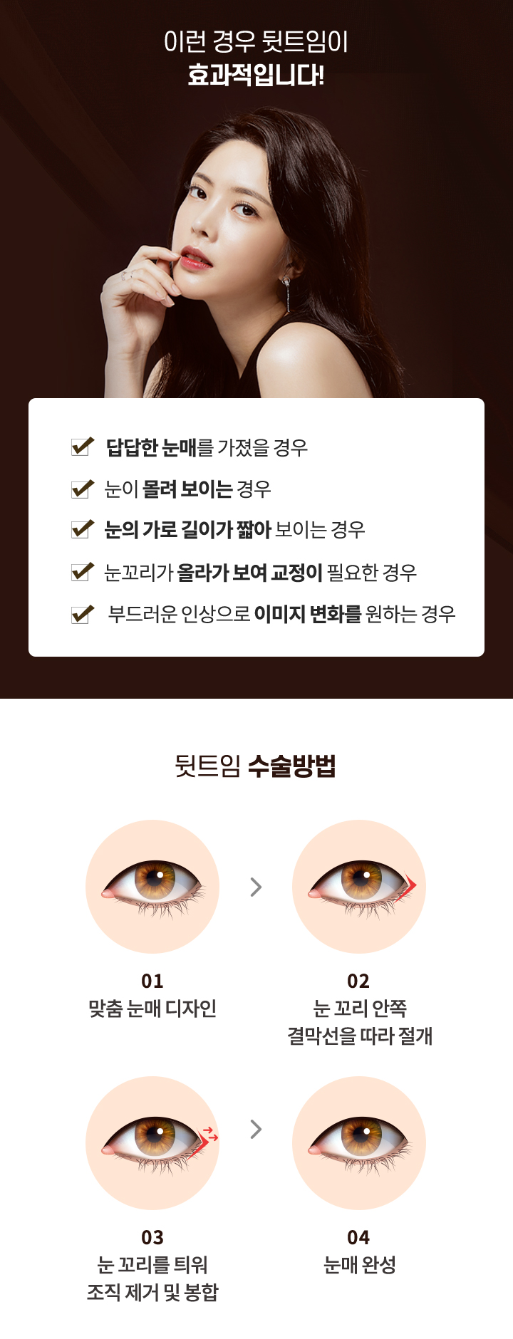 이런경우뒷트임이 효과적입니다