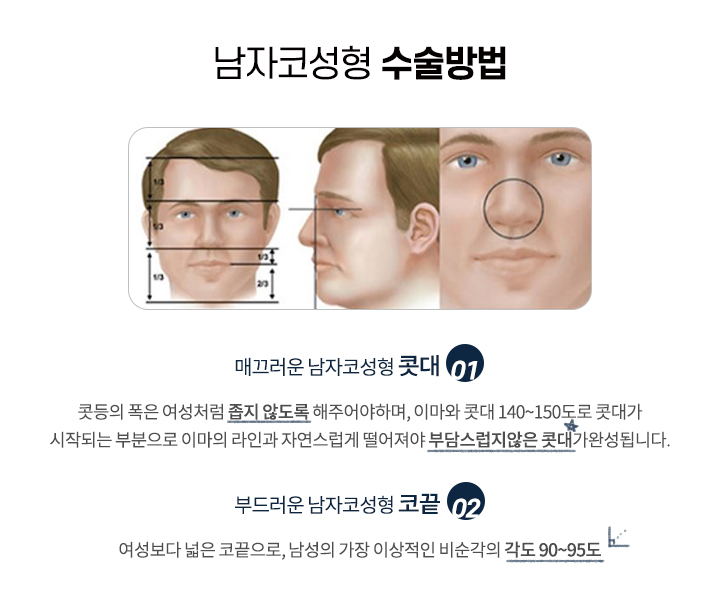 남자코성형 수술방법