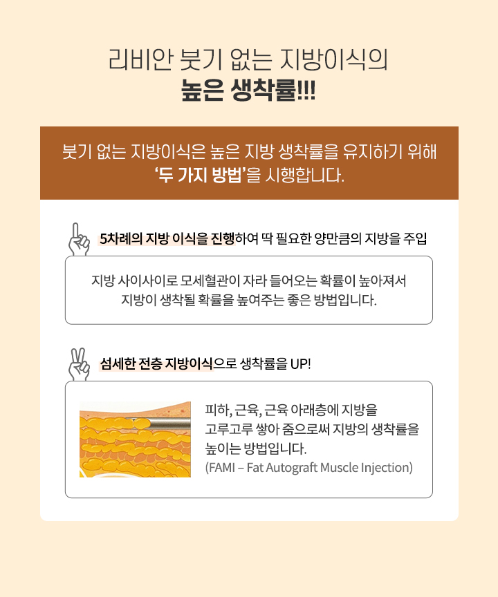 붓기없는 지방이식 높은 생착률