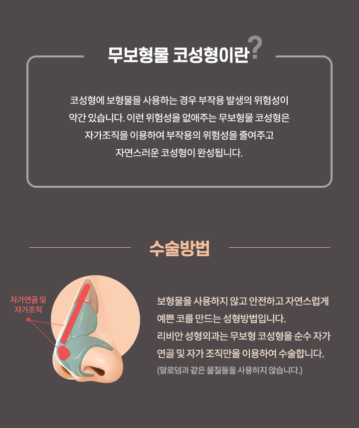 무보형물 코성형이란?, 수술방법