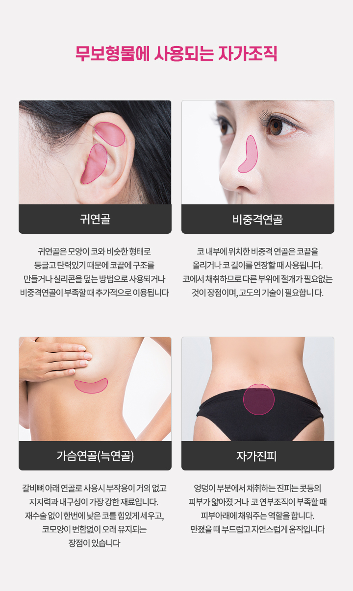 무보형물에 사용되는 자가조직